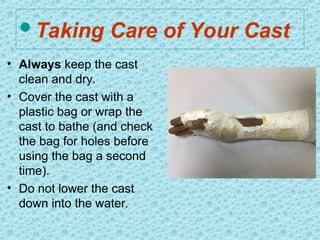 Taking Care of Your Cast
• Always keep the cast
clean and dry.
• Cover the cast with a
plastic bag or wrap the
cast to bathe (and check
the bag for holes before
using the bag a second
time).
• Do not lower the cast
down into the water.
 