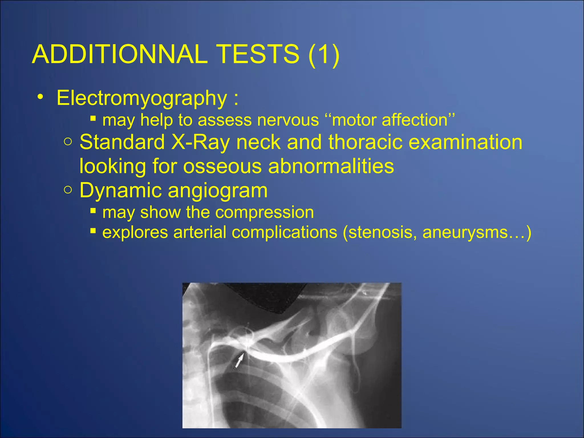ADDITIONNAL TESTS (1) Electromyography : may help to assess nervous ‘‘motor affection’’ Standard X-Ray neck and thoracic examination looking for osseous abnormalities Dynamic angiogram may show the compression explores arterial complications (stenosis, aneurysms…) 