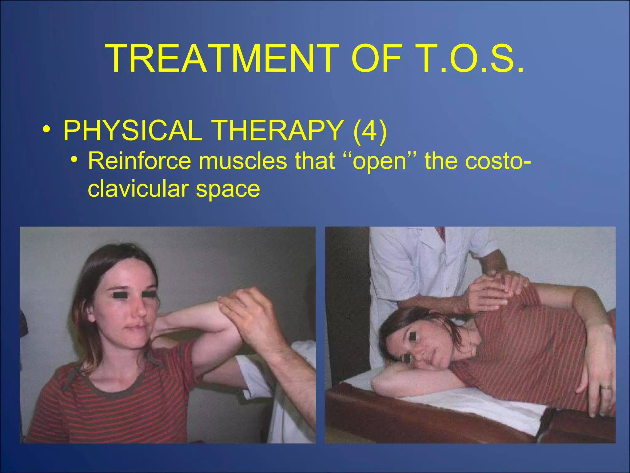 TREATMENT OF T.O.S. PHYSICAL THERAPY (4) Reinforce muscles that ‘‘open’’ the costo-clavicular space 