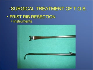 THORACIC OUTLET SYNDROM (TOS) | PPT