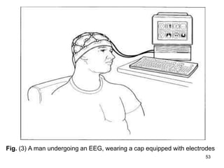 Fig. (3) A man undergoing an EEG, wearing a cap equipped with electrodes
53
 