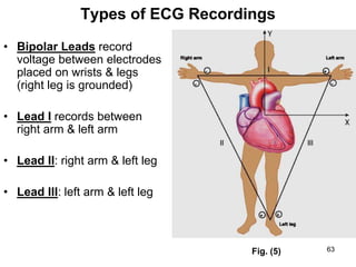 Types of ECG Recordings
• Bipolar Leads record
voltage between electrodes
placed on wrists & legs
(right leg is grounded)
• Lead I records between
right arm & left arm
• Lead II: right arm & left leg
• Lead III: left arm & left leg
Fig. (5) 63
 