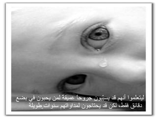 ليتعلموا أنهم قد يسبّبون جروحاً عميقةً لمن يحبون في بضع دقائق فقط، لكن قد يحتاجون لمداواتهم سنوات ٍطويلة  