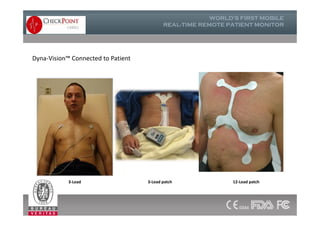 Dyna-Vision™ Connected to Patient
3-Lead 3-Lead patch 12-Lead patch
 