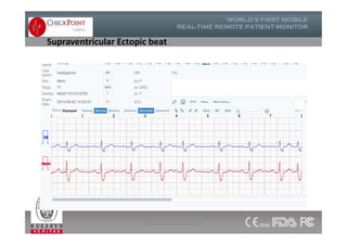 Supraventricular Ectopic beat
www.checkpointcardio.com
 