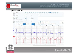 Atrial Flutter
www.checkpointcardio.com
 