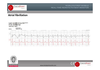 Atrial fibrillation
www.checkpointcardio.com
 