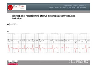 Registration of reestablishing of sinus rhythm on patient with Atrial
fibrillation
www.checkpointcardio.com
 