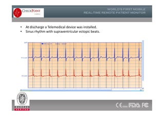 • At discharge a Telemedical device was installed.
• Sinus rhythm with supraventricular ectopic beats.
 