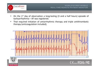 • On the 1st day of observation a long-lasting (3 and a half hours) episode of
tachyarrhythmia – AF was registered.
• That required initiation of antiarrhythmic therapy and triple antithrombotic
therapy (anticoagulation included).
 