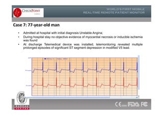 • Admitted at hospital with initial diagnosis Unstable Angina;
• During hospital stay no objective evidence of myocardial necrosis or inducible ischemia
was found
• At discharge Telemedical device was installed; telemonitoring revealed multiple
prolonged episodes of significant ST segment depression in modified V5 lead.
Case 7: 77-year-old man
 