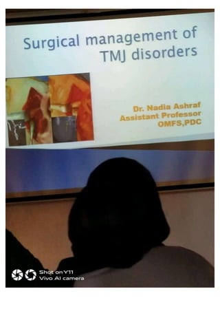 83.SURGICAL MANAGEMENT OF TMJ DISORDERS.pptx