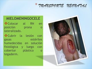 MIELOMENINGOCELE
Colocar        al   RN   en
posición         prona     o
lateralizado.
Cubrir    la  lesión con
gasas              estériles
humedecidas en solución
fisiológica y luego con
cobertor     plástico      o
tegaderm.
 
