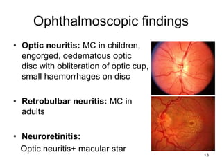 Ophthalmoscopic findings
• Optic neuritis: MC in children,
engorged, oedematous optic
disc with obliteration of optic cup,
small haemorrhages on disc
• Retrobulbar neuritis: MC in
adults
• Neuroretinitis:
Optic neuritis+ macular star
13
 