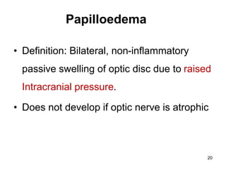Papilloedema
• Definition: Bilateral, non-inflammatory
passive swelling of optic disc due to raised
Intracranial pressure.
• Does not develop if optic nerve is atrophic
20
 