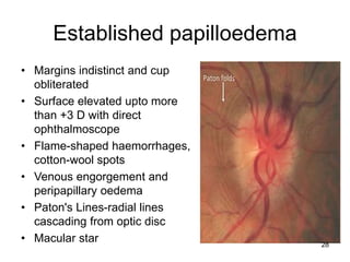 Established papilloedema
• Margins indistinct and cup
obliterated
• Surface elevated upto more
than +3 D with direct
ophthalmoscope
• Flame-shaped haemorrhages,
cotton-wool spots
• Venous engorgement and
peripapillary oedema
• Paton's Lines-radial lines
cascading from optic disc
• Macular star 28
 
