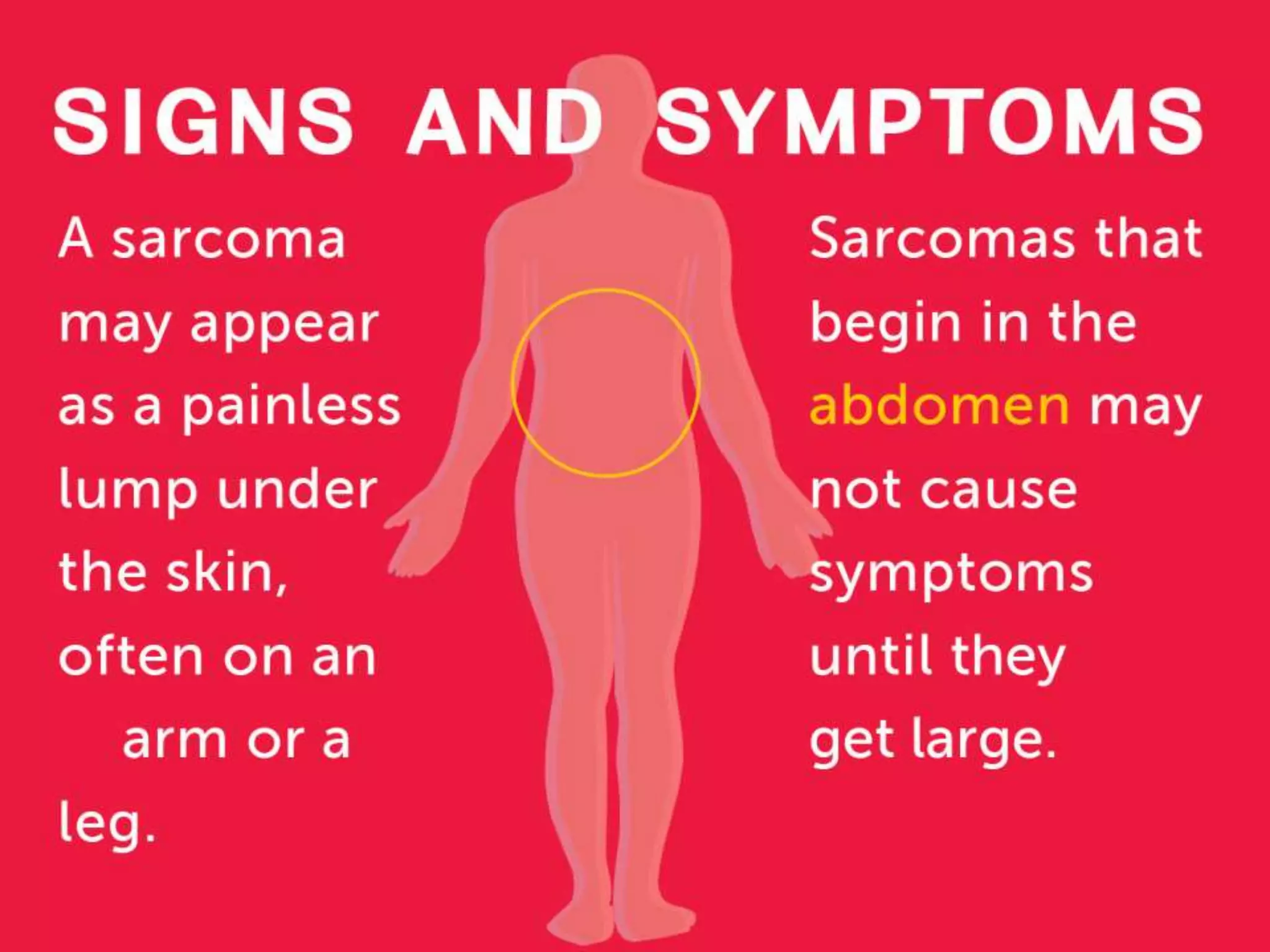 Soft Tissue Sarcomas: Symptoms and Risk Factors