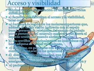 Acceso y visibilidad
 