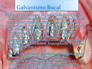 Galvanismo Bucal
 