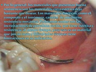 83324   82239 Odo 061 2009 3