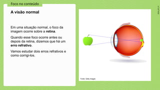 2024_AF_V1
Foco no conteúdo
Em uma situação normal, o foco da
imagem ocorre sobre a retina.
Quando esse foco ocorre antes ou
depois da retina, dizemos que há um
erro refrativo.
Vamos estudar dois erros refrativos e
como corrigi-los.
A visão normal
Fonte: Getty Images
 