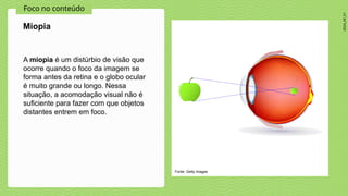 2024_AF_V1
Foco no conteúdo
A miopia é um distúrbio de visão que
ocorre quando o foco da imagem se
forma antes da retina e o globo ocular
é muito grande ou longo. Nessa
situação, a acomodação visual não é
suficiente para fazer com que objetos
distantes entrem em foco.
Miopia
Fonte: Getty Images
 