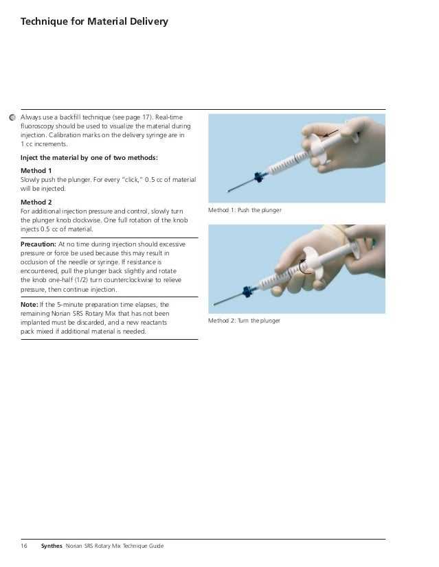 Norian SRS Rotary Mix