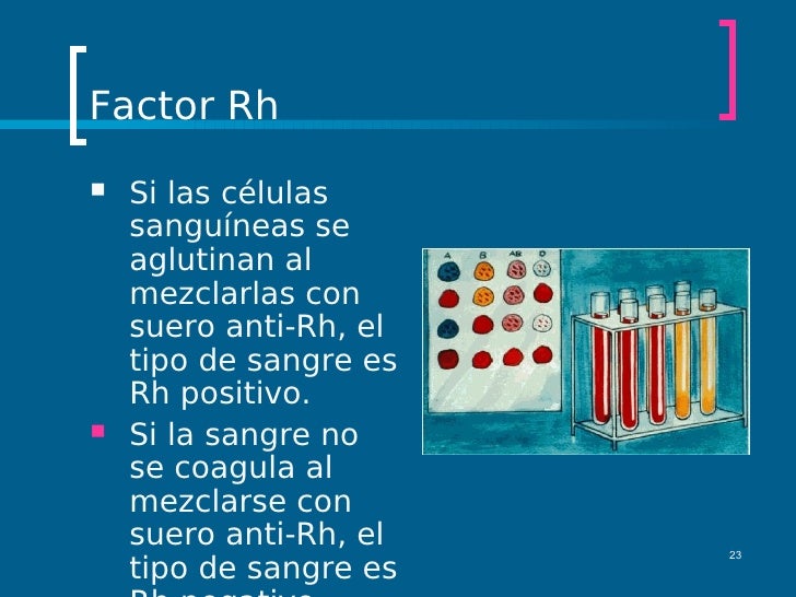 Como las lombrices funcionan al organismo de la persona