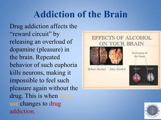 Addiction of the Brain
Drug addiction affects the
“reward circuit” by
releasing an overload of
dopamine (pleasure) in
the brain. Repeated
behavior of such euphoria
kills neurons, making it
impossible to feel such
pleasure again without the
drug. This is when drug
use changes to drug
addiction.
 