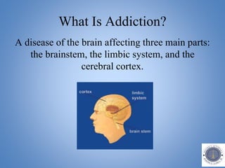 What Is Addiction?
A disease of the brain affecting three main parts:
the brainstem, the limbic system, and the
cerebral cortex.
 