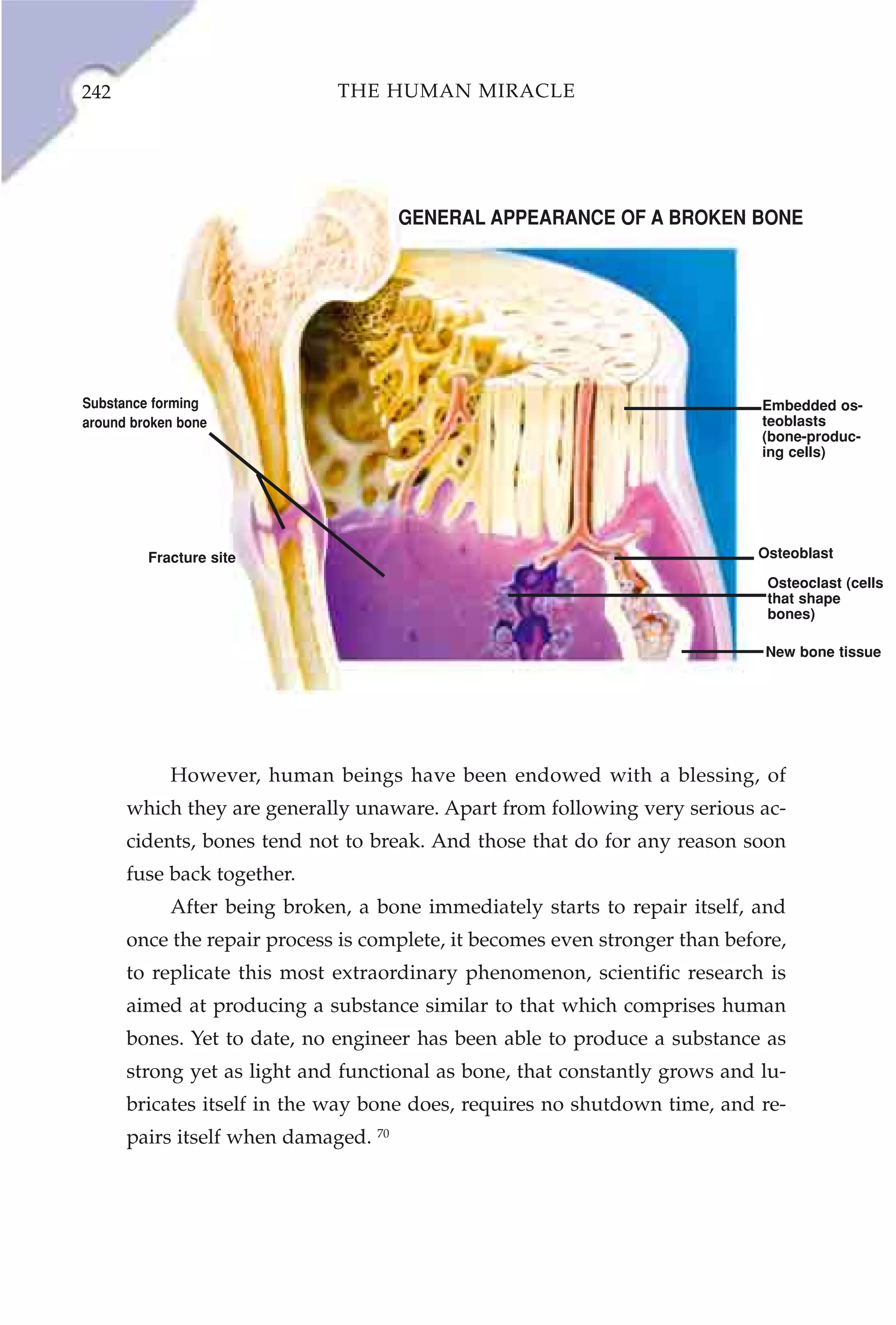 242                           THE HUMAN MIRACLE




                                      GENERAL APPEARANCE OF A BROKEN BONE




Substance forming                                                            Embedded os-
around broken bone                                                           teoblasts
                                                                             (bone-produc-
                                                                             ing cells)




         Fracture site                                                      Osteoblast

                                                                             Osteoclast (cells
                                                                             that shape
                                                                             bones)

                                                                             New bone tissue




            However, human beings have been endowed with a blessing, of
      which they are generally unaware. Apart from following very serious ac-
      cidents, bones tend not to break. And those that do for any reason soon
      fuse back together.
            After being broken, a bone immediately starts to repair itself, and
      once the repair process is complete, it becomes even stronger than before,
      to replicate this most extraordinary phenomenon, scientific research is
      aimed at producing a substance similar to that which comprises human
      bones. Yet to date, no engineer has been able to produce a substance as
      strong yet as light and functional as bone, that constantly grows and lu-
      bricates itself in the way bone does, requires no shutdown time, and re-
      pairs itself when damaged. 70
 