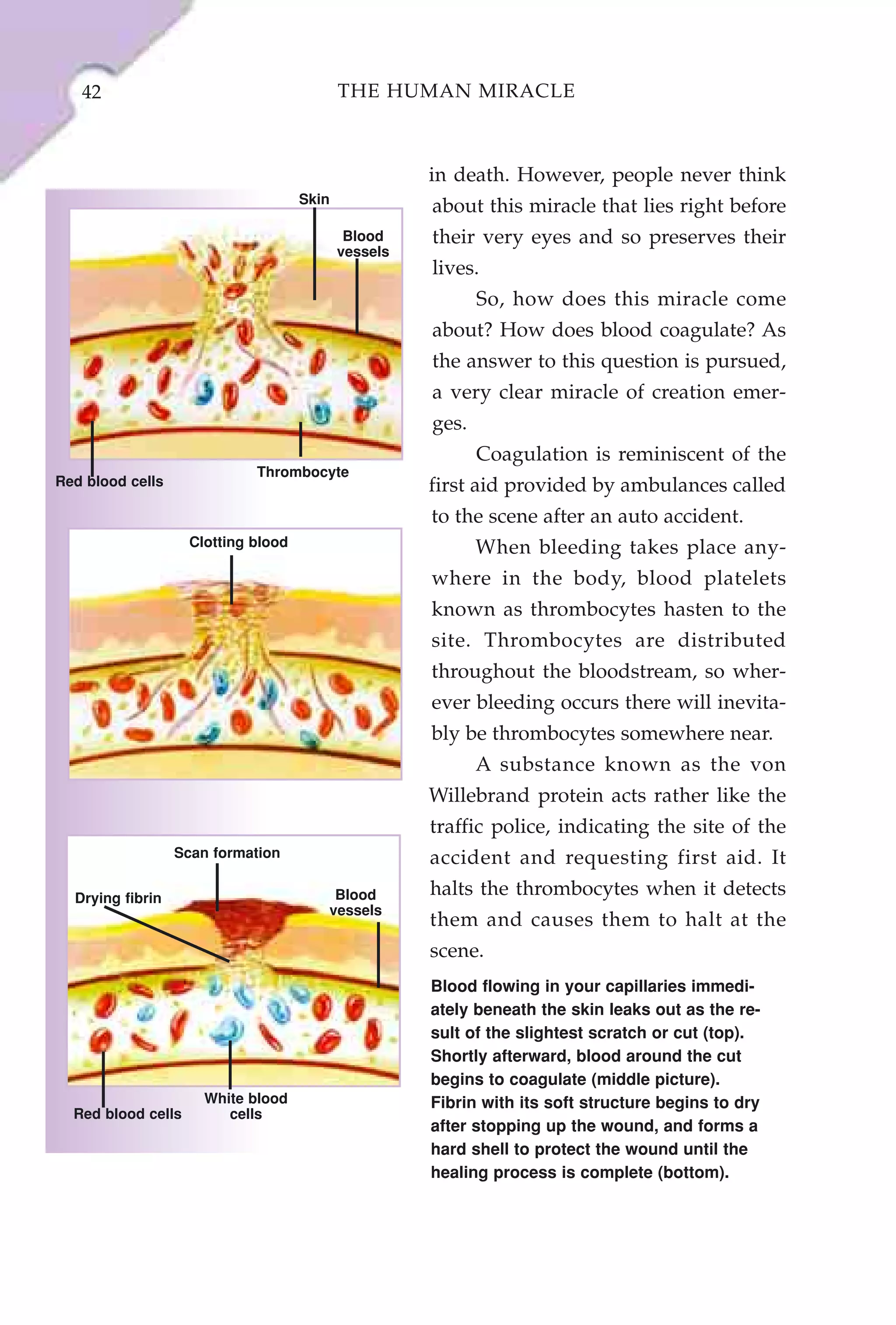 42                                       THE HUMAN MIRACLE



                                                      in death. However, people never think
                                     Skin
                                                      about this miracle that lies right before
                                             Blood    their very eyes and so preserves their
                                            vessels
                                                      lives.
                                                             So, how does this miracle come
                                                      about? How does blood coagulate? As
                                                      the answer to this question is pursued,
                                                      a very clear miracle of creation emer-
                                                      ges.
                                                             Coagulation is reminiscent of the
                             Thrombocyte
Red blood cells                                       first aid provided by ambulances called
                                                      to the scene after an auto accident.
                    Clotting blood                           When bleeding takes place any-
                                                      where in the body, blood platelets
                                                      known as thrombocytes hasten to the
                                                      site. Thrombocytes are distributed
                                                      throughout the bloodstream, so wher-
                                                      ever bleeding occurs there will inevita-
                                                      bly be thrombocytes somewhere near.
                                                             A substance known as the von
                                                      Willebrand protein acts rather like the
                                                      traffic police, indicating the site of the
                  Scan formation                      accident and requesting first aid. It
  Drying fibrin                          Blood        halts the thrombocytes when it detects
                                        vessels
                                                      them and causes them to halt at the
                                                      scene.
                                                      Blood flowing in your capillaries immedi-
                                                      ately beneath the skin leaks out as the re-
                                                      sult of the slightest scratch or cut (top).
                                                      Shortly afterward, blood around the cut
                                                      begins to coagulate (middle picture).
                      White blood                     Fibrin with its soft structure begins to dry
  Red blood cells        cells
                                                      after stopping up the wound, and forms a
                                                      hard shell to protect the wound until the
                                                      healing process is complete (bottom).
 