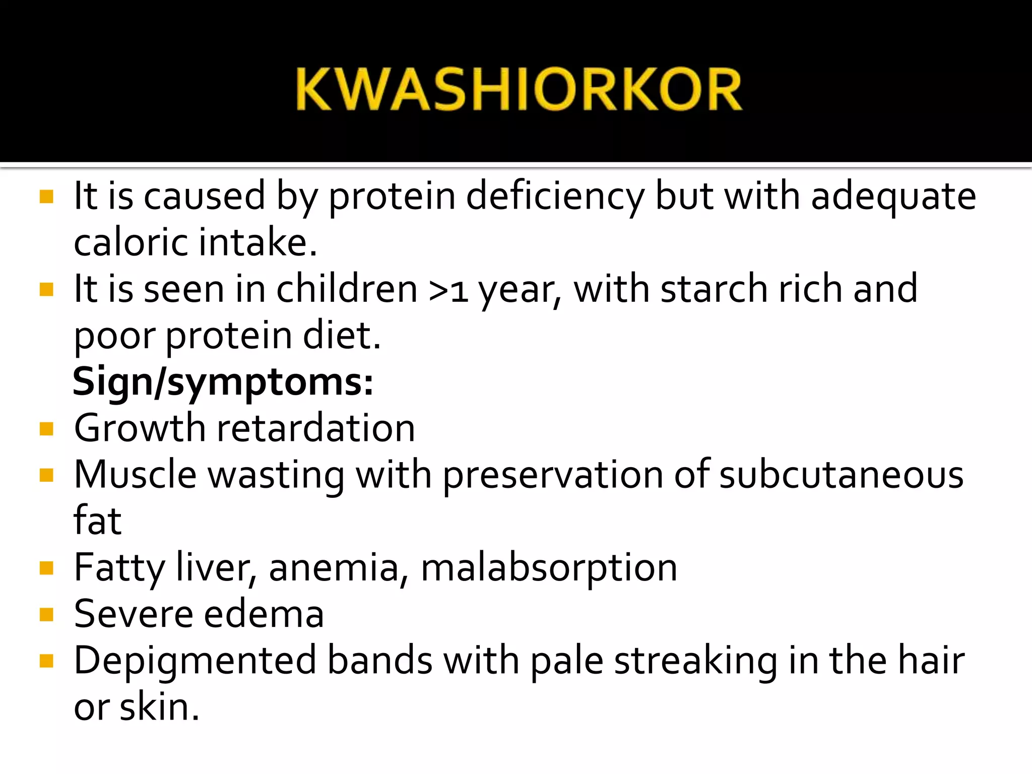  It is caused by protein deficiency but with adequate
caloric intake.
 It is seen in children >1 year, with starch rich and
poor protein diet.
Sign/symptoms:
 Growth retardation
 Muscle wasting with preservation of subcutaneous
fat
 Fatty liver, anemia, malabsorption
 Severe edema
 Depigmented bands with pale streaking in the hair
or skin.
 