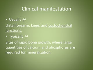 Clinical manifestation 
• Usually @ 
distal forearm, knee, and costochondral 
junctions. 
• Typically @ 
Sites of rapid bone growth, where large 
quantities of calcium and phosphorus are 
required for mineralization. 
 
