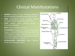 Clinical Manifestations 
• GENERAL Failure to thrive; Protuding abdomen; 
Muscle weakness (especially proximal); Fractures 
• HEAD Craniotabes; Frontal bossing; Delayed 
fontanelle closure; Delayed dentition; caries 
• CHEST Rachitic rosary; Harrison groove; or 
Respiratory infections 
• BACK Scoliosis ,Kyphosis ,Lordosis 
• EXTREMITIES Enlargement of wrists and ankles; 
Valgus or varus deformities Windswept deformity 
(combination of valgus deformity of 1 leg with 
varus deformity of the other leg); Anterior bowing 
of the tibia and femur; Leg pain. 
• HYPOCALCEMIC SYMPTOMS Tetany, Seizures; 
Stridor due to laryngeal spasm 
 