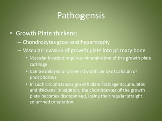 Pathogensis 
• Growth Plate thickens: 
– Chondrocytes grow and hypertrophy 
– Vascular invasion of growth plate into primary bone 
• Vascular invasion requires mineralization of the growth plate 
cartilage 
• Can be delayed or prevent by deficiency of calcium or 
phosphorous 
• In such circumstances growth plate cartilage accumulates 
and thickens. In addition, the chondrocytes of the growth 
plate becomes disorganised, losing their regular straight 
columned orientation. 
 