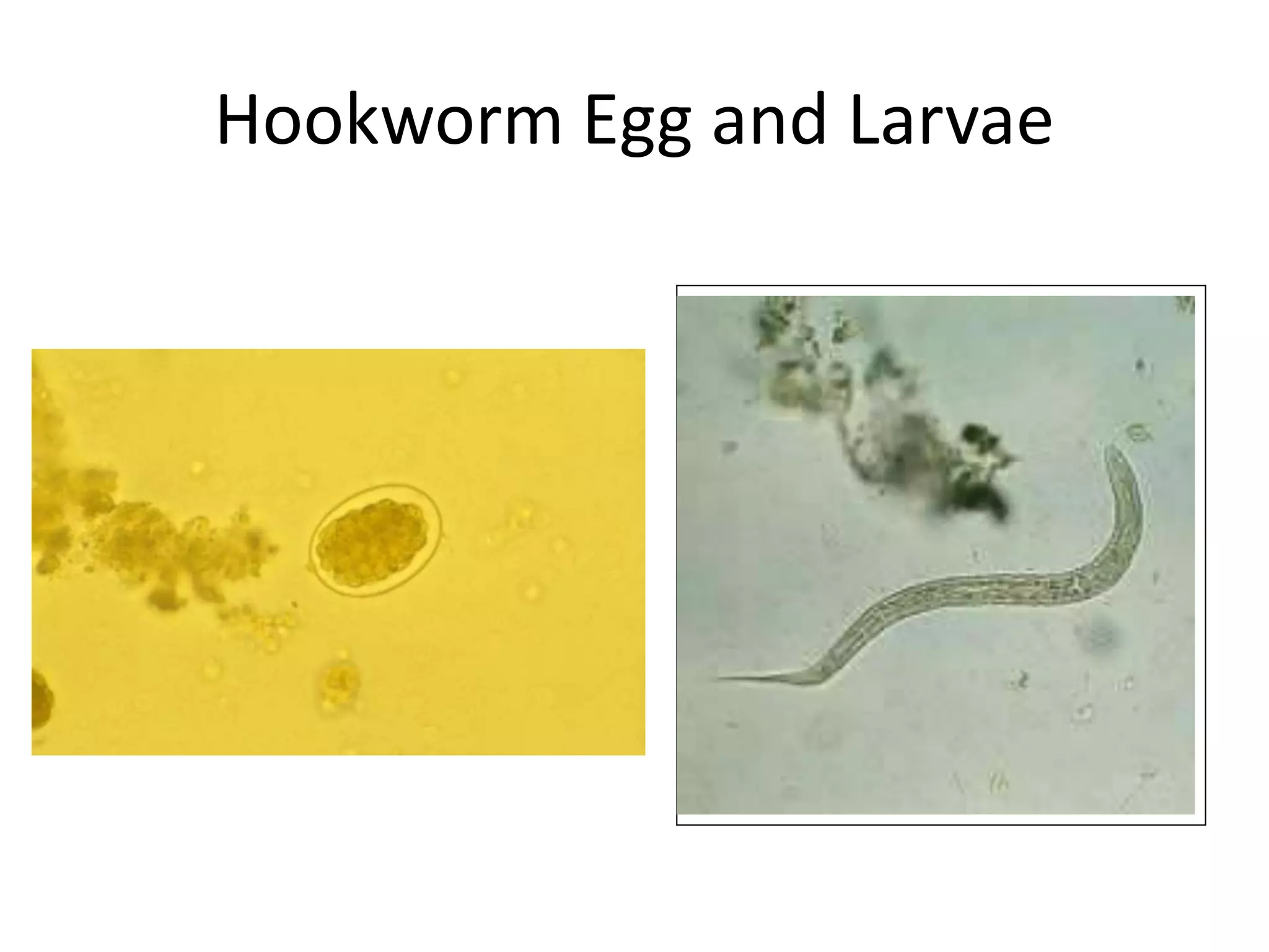 Hookworm Egg and Larvae

 