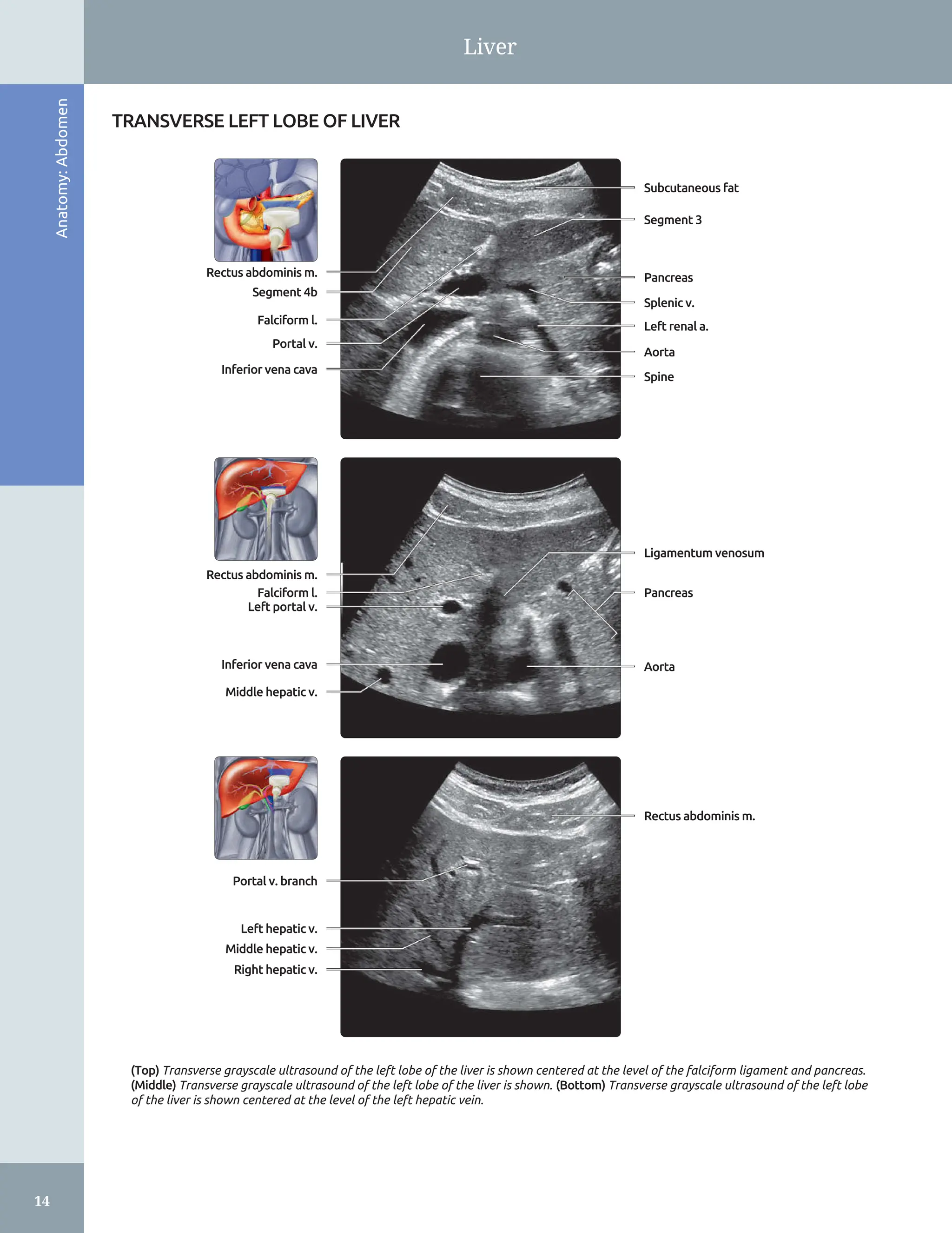 Diagnostic Ultrasound: Abdomen and Pelvis 2nd Edition Aya Kamaya | PDF