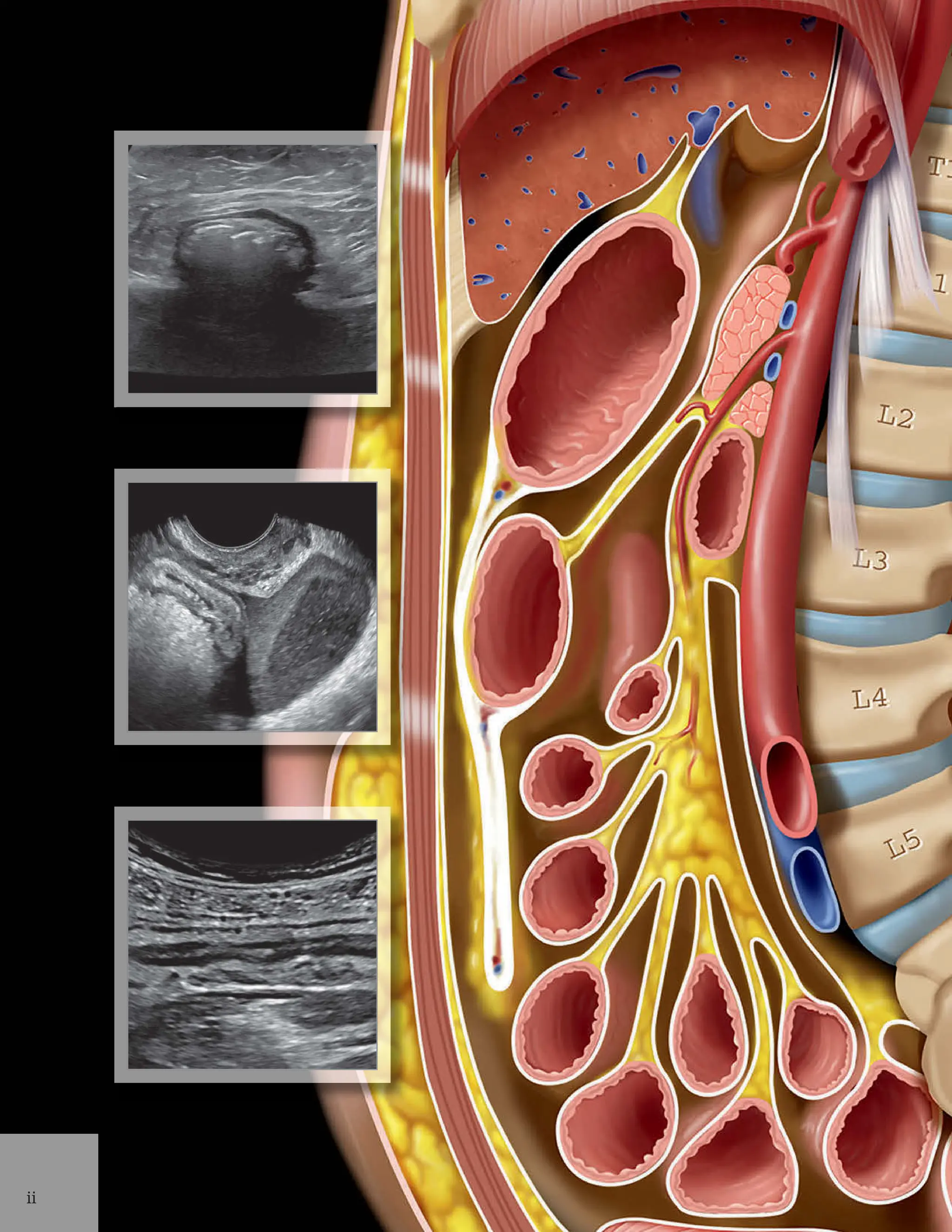 Diagnostic radiology of the abdomen 2e Diagnostic Imaging: Abdomen