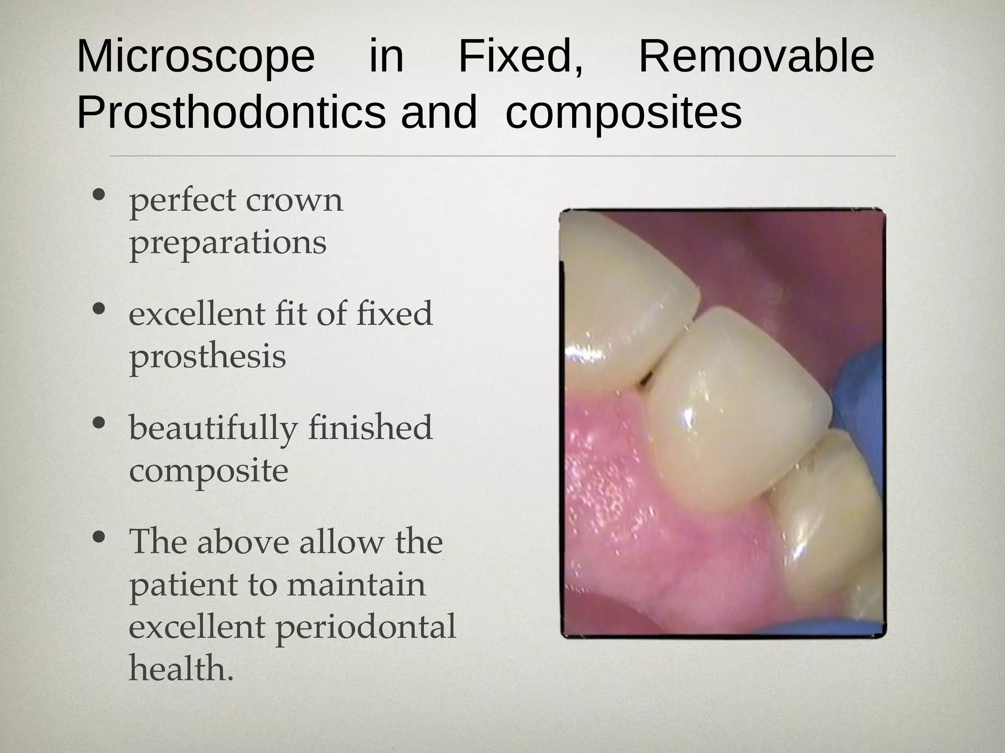 Microscope in Fixed, Removable 
Prosthodontics and composites 
• perfect crown 
preparations 
• excellent fit of fixed 
prosthesis 
• beautifully finished 
composite 
• The above allow the 
patient to maintain 
excellent periodontal 
health. 
 