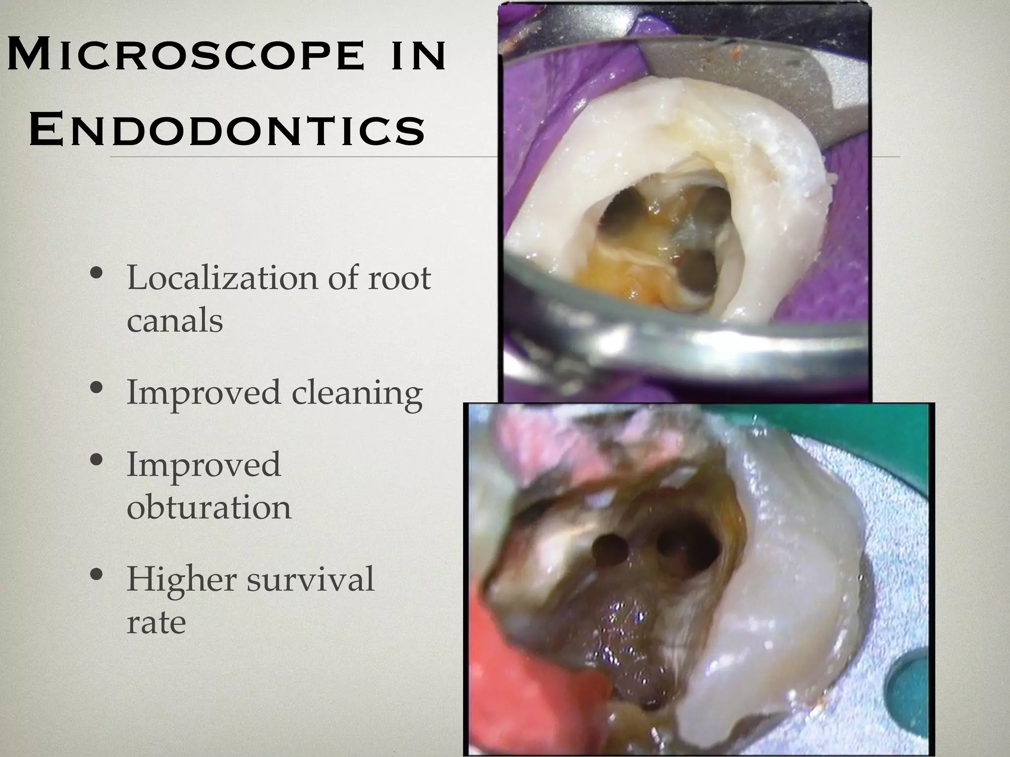 Microscope in 
Endodontics 
• Localization of root 
canals 
• Improved cleaning 
• Improved 
obturation 
• Higher survival 
rate 
 