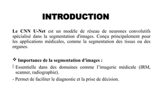 U-Net: Advanced CNN Architecture for Precise Medical Image Segmentation ...