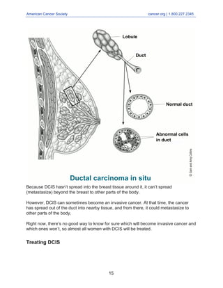 American Cancer Society cancer.org | 1.800.227.2345
____________________________________________________________________________________
Because DCIS hasn’t spread into the breast tissue around it, it can’t spread
(metastasize) beyond the breast to other parts of the body.
However, DCIS can sometimes become an invasive cancer. At that time, the cancer
has spread out of the duct into nearby tissue, and from there, it could metastasize to
other parts of the body.
Right now, there’s no good way to know for sure which will become invasive cancer and
which ones won’t, so almost all women with DCIS will be treated.
Treating DCIS
15
 