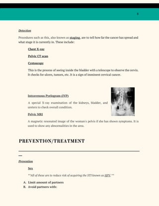 8
Detection
Procedures such as this, also known as ​staging​, are to tell how far the cancer has spread and
what stage it is currently in. These include:
Chest X-ray
Pelvic CT scan
Cystoscopy
This is the process of seeing inside the bladder with a telescope to observe the cervix.
It checks for ulcers, tumors, etc. It is a sign of imminent cervical cancer.
Intravenous Pyelogram (IVP)
A special X-ray examination of the kidneys, bladder, and
ureters to check overall condition.
Pelvic MRI
A magnetic resonated image of the woman's pelvis if she has shown symptoms. It is
used to show any abnormalities in the area.
PREVENTION/TREATMENT
_____________________________________________________________________________________________________
___
Prevention
Sex
**All of these are to reduce risk of acquiring the STI known as ​HPV​.**
A. Limit amount of partners
B. Avoid partners with:
 