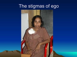 The stigmas of ego
 