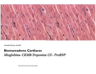 Mayo, 2010,Troponina Ultrasensible, Page 1,
Armando Moreno, Jul 2011
Biomarcadores Cardiacos
Mioglobina- CKMB-Troponina US - ProBNP
 