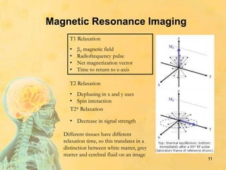 Magnetic Resonance Imaging
11
• β0 magnetic field
• Radiofrequency pulse
• Net magnetization vector
• Time to return to z-axis
T1 Relaxation
T2 Relaxation
• Dephasing in x and y axes
• Spin interaction
T2* Relaxation
• Decrease in signal strength
Different tissues have different
relaxation time, so this translates in a
distinction between white matter, grey
matter and cerebral fluid on an image
 