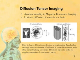 12
Diffusion Tensor Imaging
• Another modality in Magnetic Resonance Imaging
• Looks at diffusion of water in the brain
Water is free to diffuse in any direction in cerebrospinal fluid, but has
a strongly preferred direction of diffusion in a tube-like structure, as in
white matter. Studying anisotropic diffusion is especially useful for
mapping orientation of white-matter tracks.
 