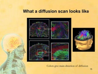 What a diffusion scan looks like
15
Colors give main direction of diffusion
 
