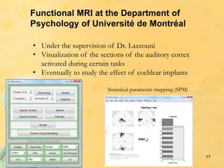 17
Functional MRI at the Department of
Psychology of Université de Montréal
• Under the supervision of Dr. Lazzouni
• Visualization of the sections of the auditory cortex
activated during certain tasks
• Eventually to study the effect of cochlear implants
Statistical parametric mapping (SPM)
 